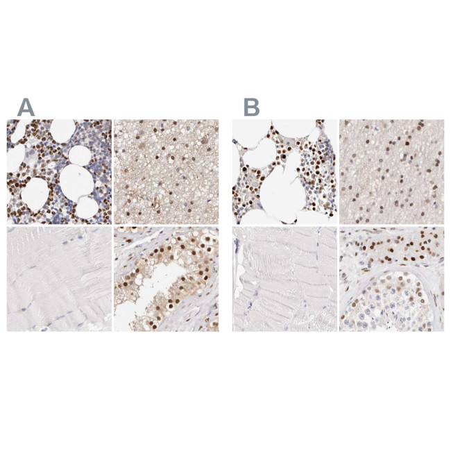 Transketolase Antibody in Immunohistochemistry (IHC)