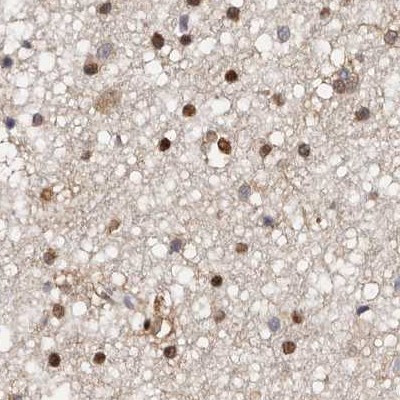 Transketolase Antibody in Immunohistochemistry (IHC)