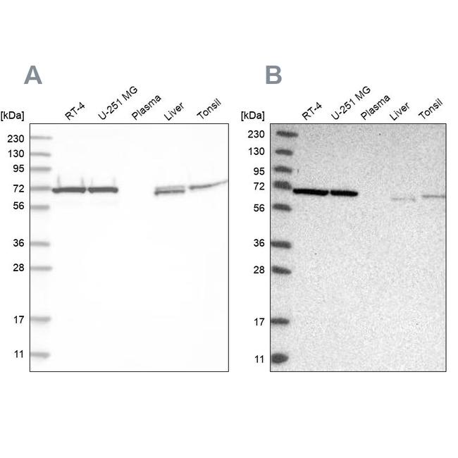 Transketolase Antibody in Western Blot (WB)