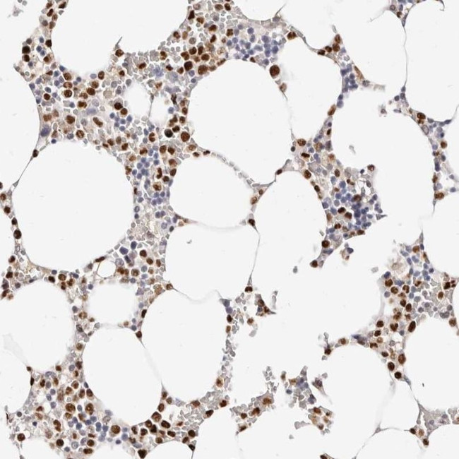 Transketolase Antibody in Immunohistochemistry (IHC)