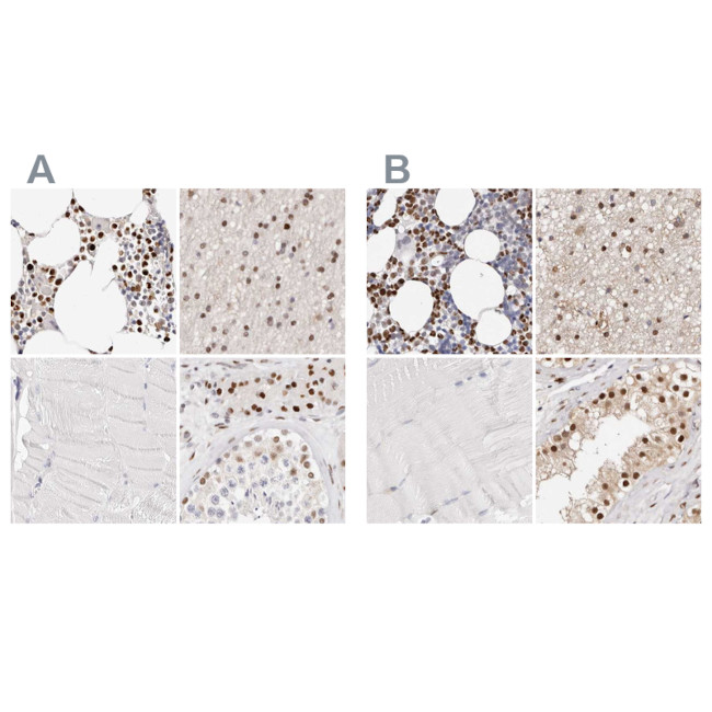 Transketolase Antibody in Immunohistochemistry (IHC)