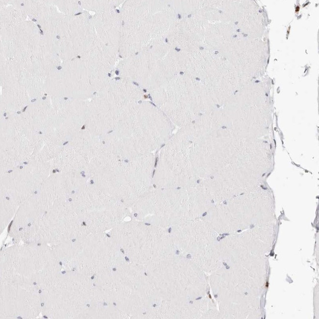 Transketolase Antibody in Immunohistochemistry (IHC)