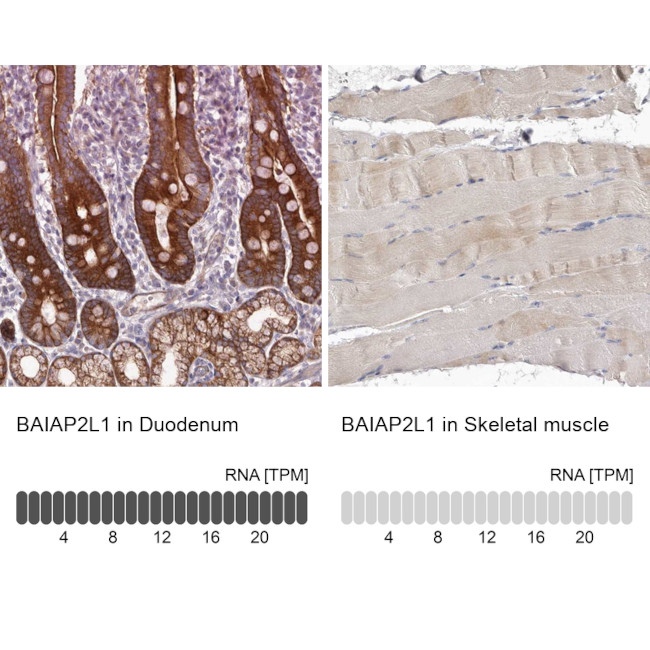 BAIAP2L1 Antibody in Immunohistochemistry (IHC)