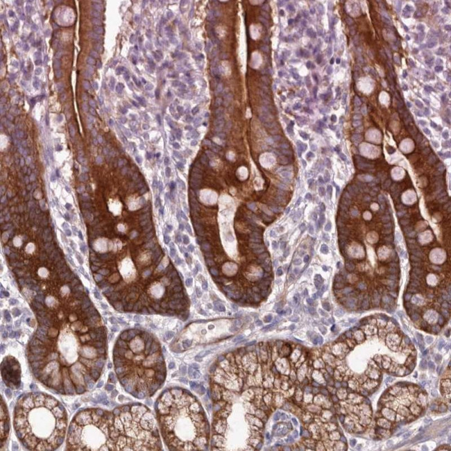 BAIAP2L1 Antibody in Immunohistochemistry (IHC)