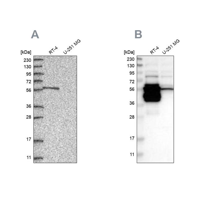 BAIAP2L1 Antibody in Western Blot (WB)