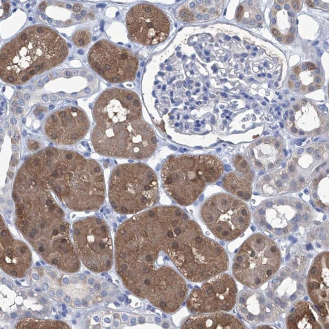 IMPA2 Antibody in Immunohistochemistry (IHC)