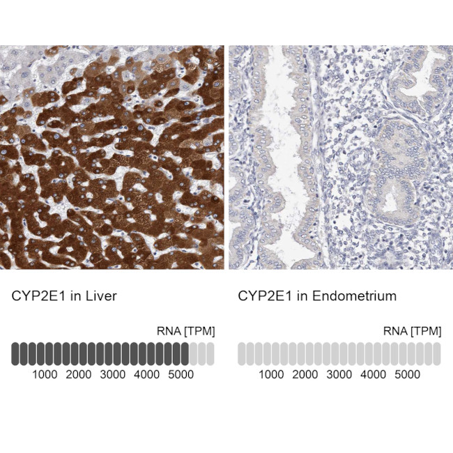 CYP2E1 Antibody in Immunohistochemistry (IHC)