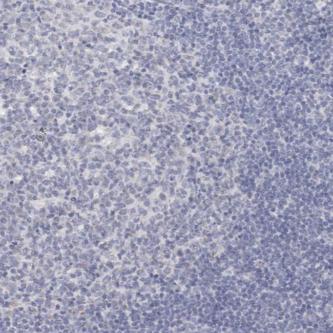 CYP2E1 Antibody in Immunohistochemistry (IHC)