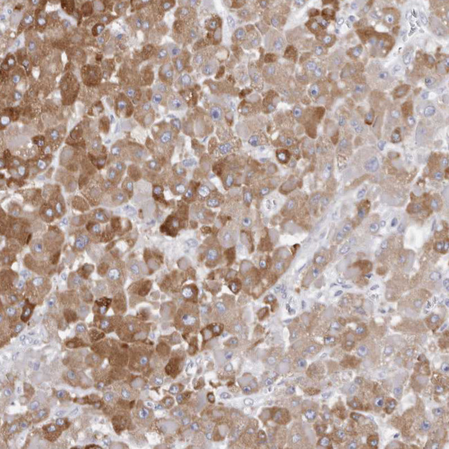 CYP2E1 Antibody in Immunohistochemistry (IHC)