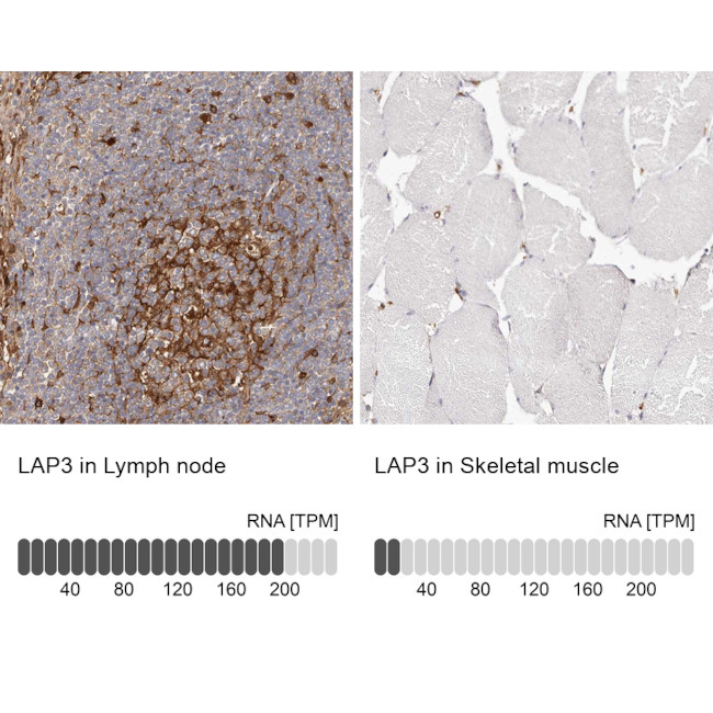 LAP3 Antibody in Immunohistochemistry (IHC)