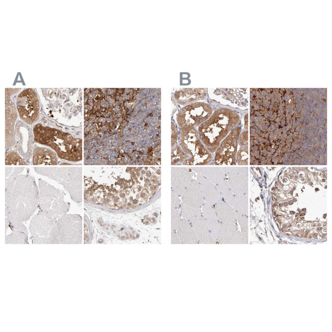 LAP3 Antibody in Immunohistochemistry (IHC)