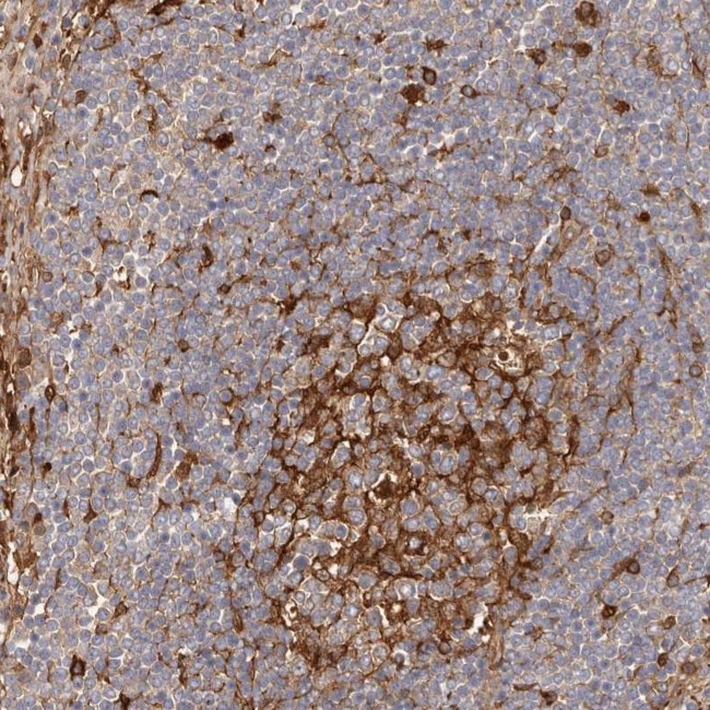 LAP3 Antibody in Immunohistochemistry (IHC)