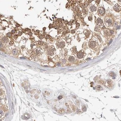 LAP3 Antibody in Immunohistochemistry (IHC)