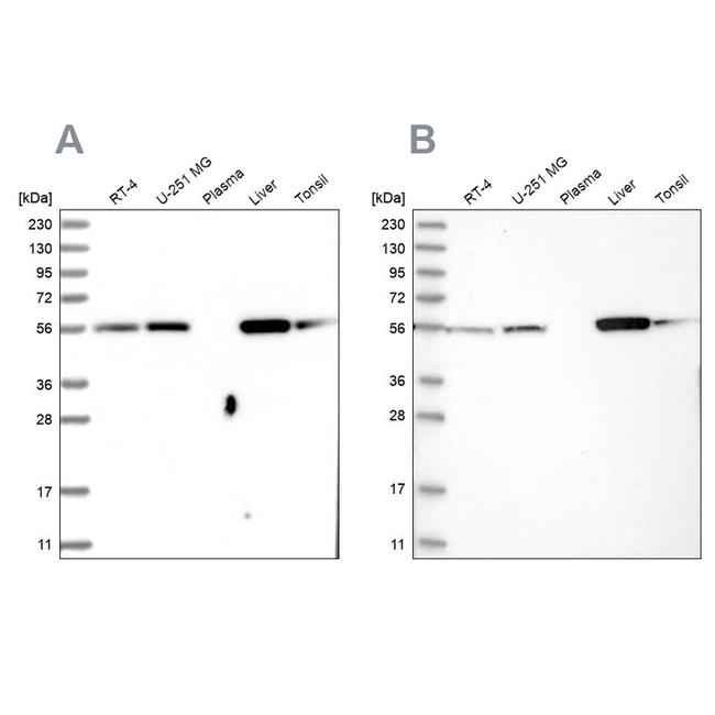 LAP3 Antibody in Western Blot (WB)