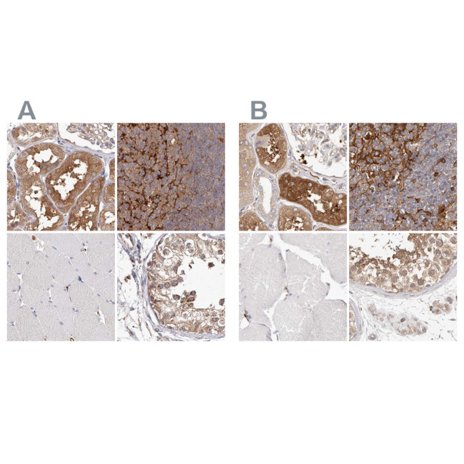 LAP3 Antibody in Immunohistochemistry (IHC)