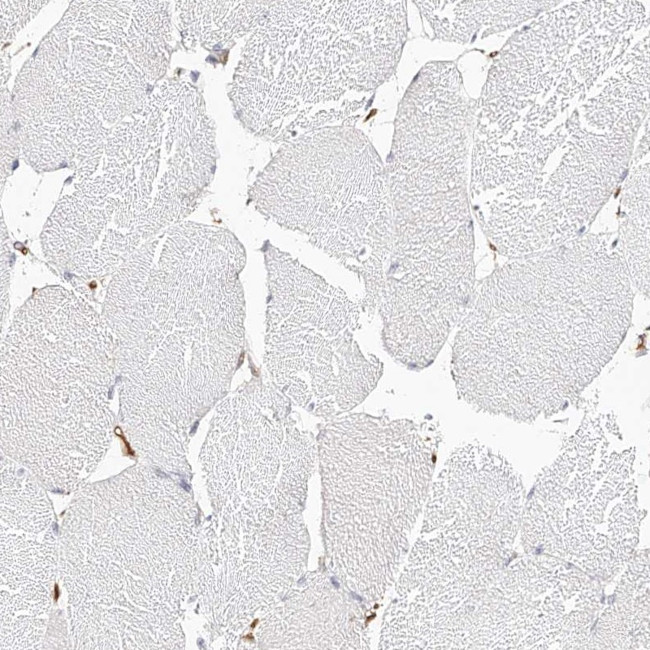 LAP3 Antibody in Immunohistochemistry (IHC)