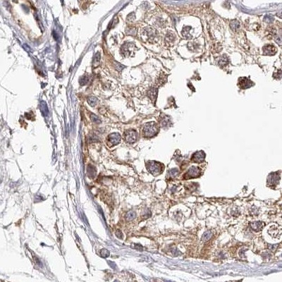 LAP3 Antibody in Immunohistochemistry (IHC)