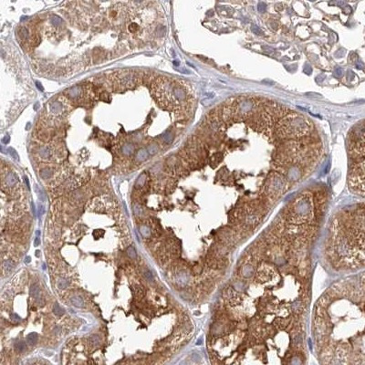 LAP3 Antibody in Immunohistochemistry (IHC)