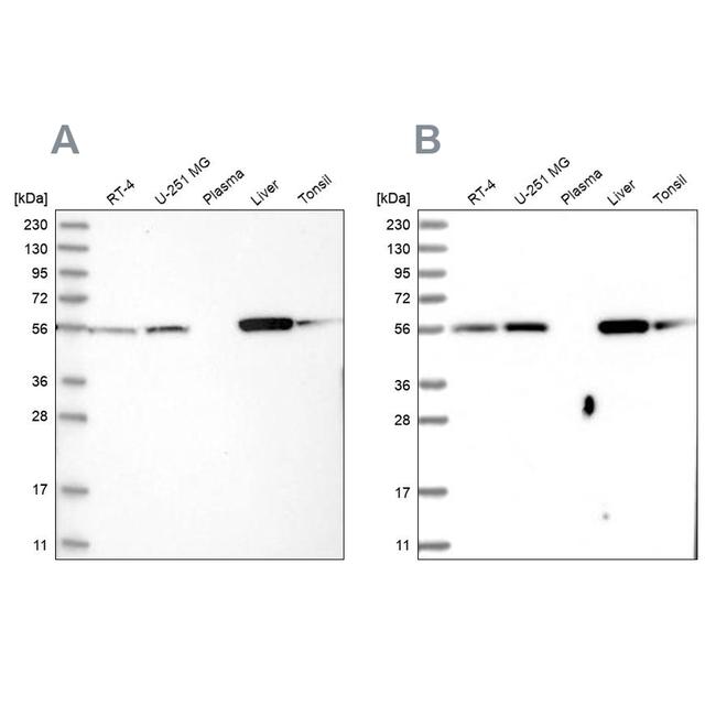 LAP3 Antibody in Western Blot (WB)