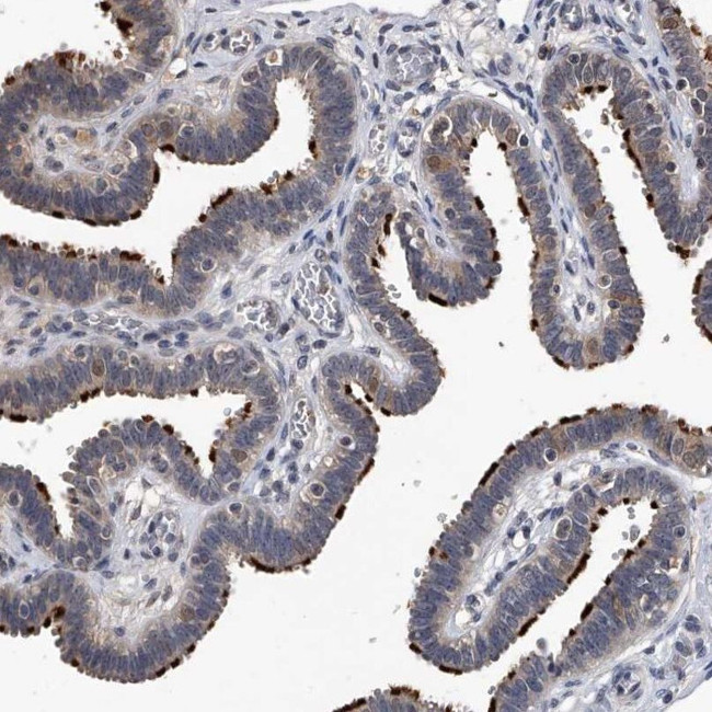 EFCAB7 Antibody in Immunohistochemistry (IHC)