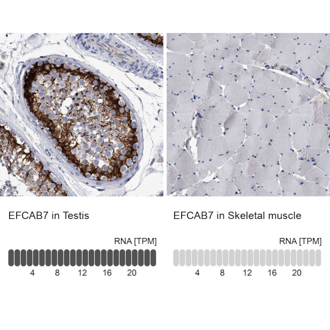 EFCAB7 Antibody in Immunohistochemistry (IHC)