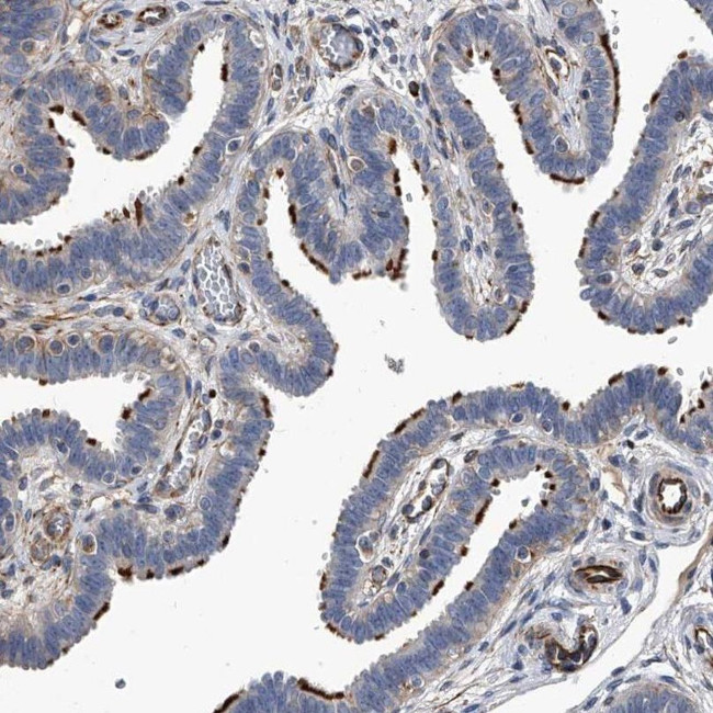 EFCAB7 Antibody in Immunohistochemistry (IHC)