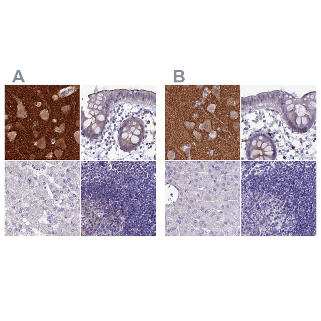 SNAP91 Antibody in Immunohistochemistry (IHC)