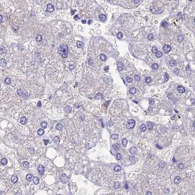 SNAP91 Antibody in Immunohistochemistry (IHC)