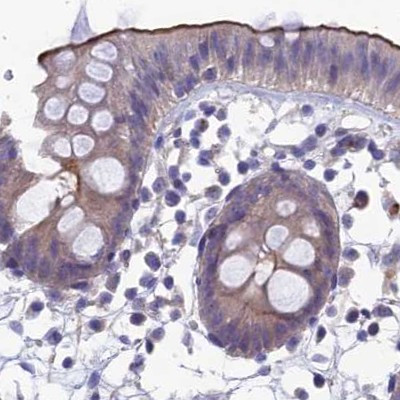 SNAP91 Antibody in Immunohistochemistry (IHC)