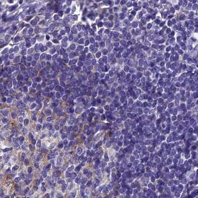 SNAP91 Antibody in Immunohistochemistry (IHC)