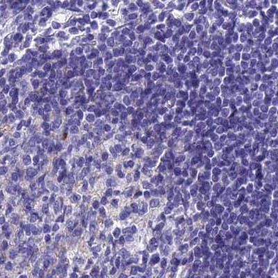 SNAP91 Antibody in Immunohistochemistry (IHC)