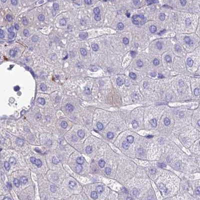 SNAP91 Antibody in Immunohistochemistry (IHC)