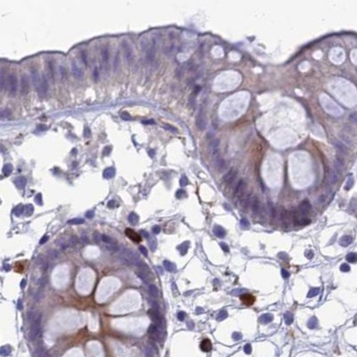 SNAP91 Antibody in Immunohistochemistry (IHC)