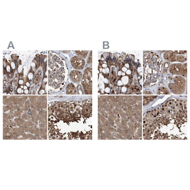 PSMB1 Antibody in Immunohistochemistry (IHC)