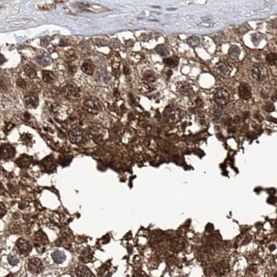 PSMB1 Antibody in Immunohistochemistry (IHC)