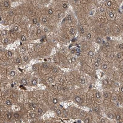 PSMB1 Antibody in Immunohistochemistry (IHC)