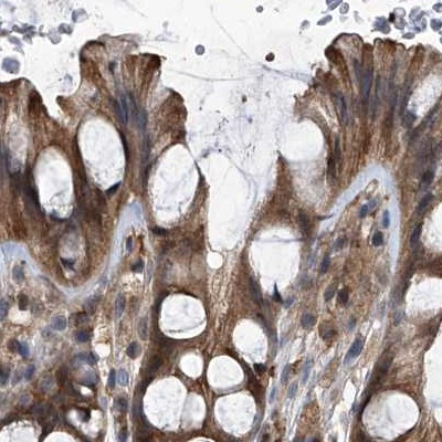 PSMB1 Antibody in Immunohistochemistry (IHC)