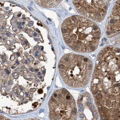 PSMB1 Antibody in Immunohistochemistry (IHC)