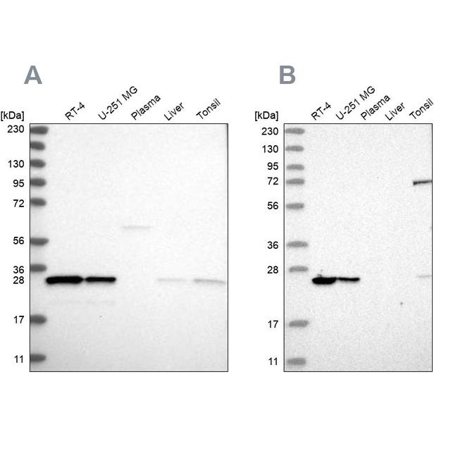 PSMB1 Antibody in Western Blot (WB)