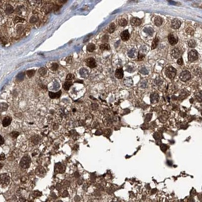 PSMB1 Antibody in Immunohistochemistry (IHC)