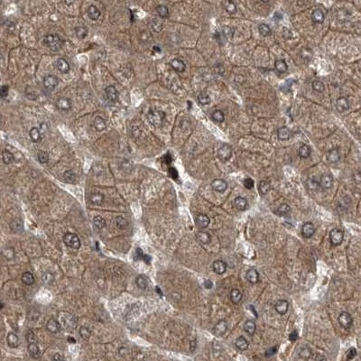 PSMB1 Antibody in Immunohistochemistry (IHC)