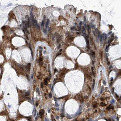 PSMB1 Antibody in Immunohistochemistry (IHC)