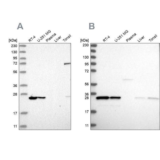 PSMB1 Antibody in Western Blot (WB)