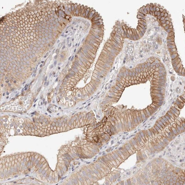 SLC35B2 Antibody in Immunohistochemistry (IHC)