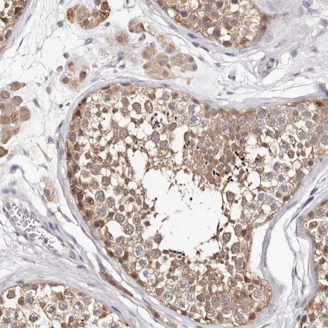 TYW3 Antibody in Immunohistochemistry (IHC)