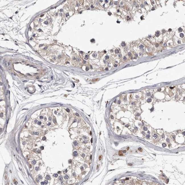 RCL Antibody in Immunohistochemistry (IHC)