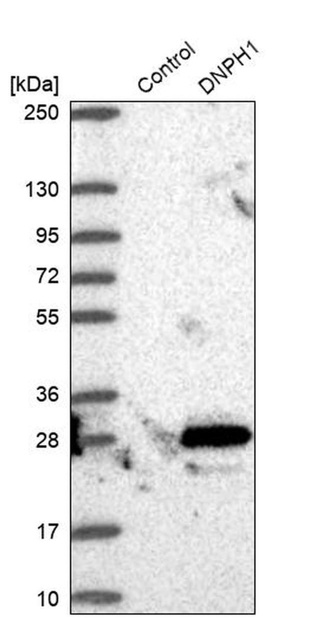 RCL Antibody in Western Blot (WB)