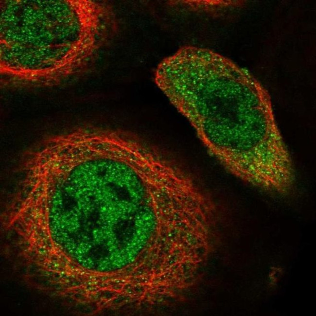 RAD23B Antibody in Immunocytochemistry (ICC/IF)