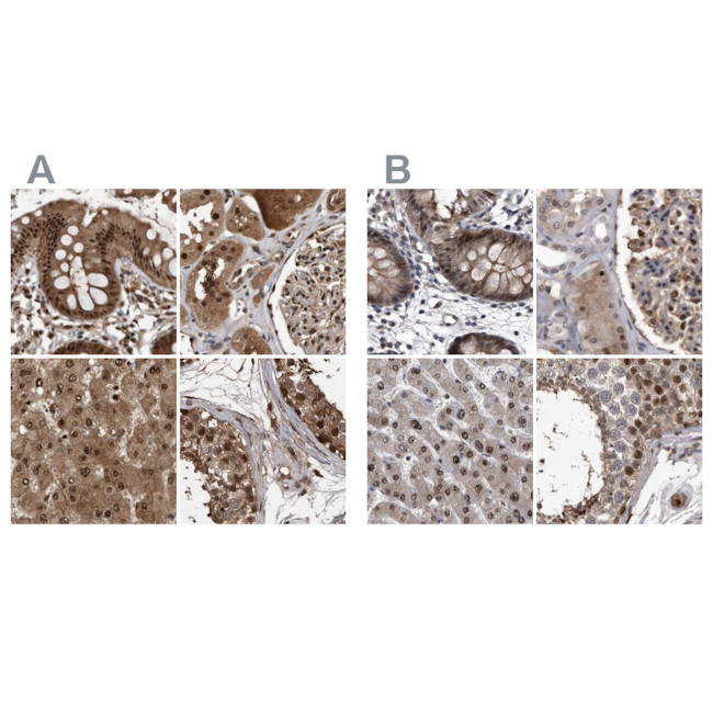 RAD23B Antibody in Immunohistochemistry (IHC)