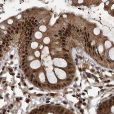 RAD23B Antibody in Immunohistochemistry (IHC)